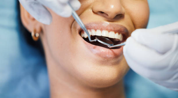 Best Emergency Dental Care for Broken or Chipped Teeth in Bull Shoals, AR